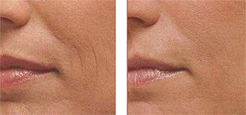 POWERFUL Anti Aging Face Serum: Matrixyl 3000 + Argireline Peptide + Vitamin C Serum with Organic Hyaluronic Acid, Serum for Wrinkles, Fine Lines