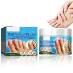 Nail Fungus Treatment Cream, 30g Strong Anti-Fungus Nail Treatment for Toenail Fungus, Fungal Nail Treatment For Athlete's Foot and Nail Infectio