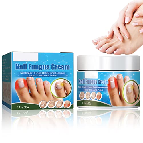 Nail Fungus Treatment Cream, 30g Strong Anti-Fungus Nail Treatment for Toenail Fungus, Fungal Nail Treatment For Athlete's Foot and Nail Infectio