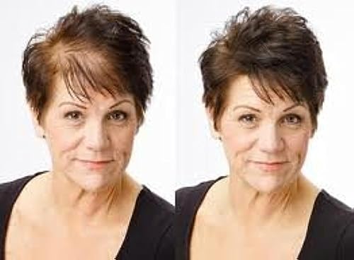 Beaver KERATIN Hair Building Fibres Hair Loss Concealer 28g Dark Brown (Beaver Fibres)