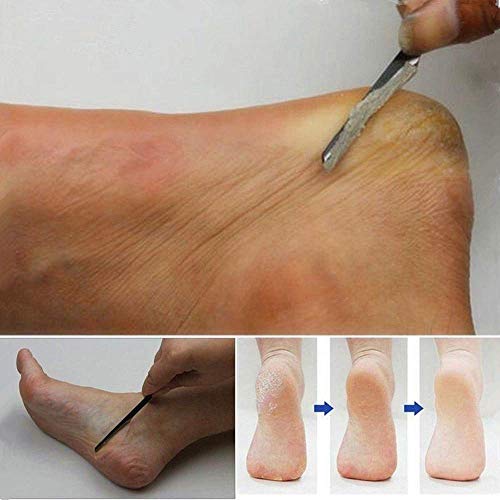 Dead Skin Removal, zukabmw Pedicure Hard Skin Remover Foot Care Callus Hard Tough Dead Skin Removal Scraper Pedicure Tool Callus Dead Dry Hard &