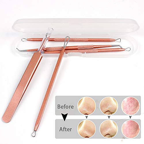 Blackhead Remover Tool 5 Pcs Blackhead Cleaner Tweezers Kit, Professional Extractor Tweezers Kit Pimple Popper for Facial Care with Case (rose go