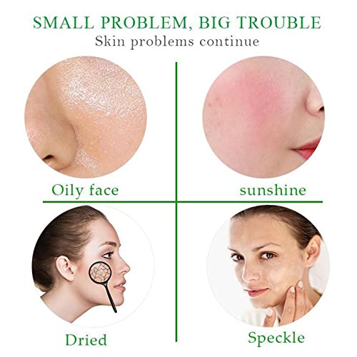 AloeVera Creams Hydrating Moisturizing Improves Sunburn Skin Care Products After Sun Repairs Moisturizer 100ml Old Man Facial Hair (d-color, One