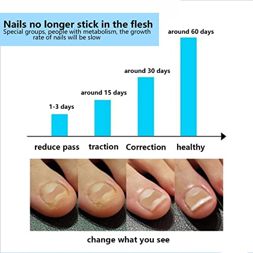 Ingrown Toenail Correction Patch Ingrown Toenail Sticker Patch 50PCS Nail Correction Sticker with 4PCS Nail Correction Tool,Glue-Free Toenail Cor