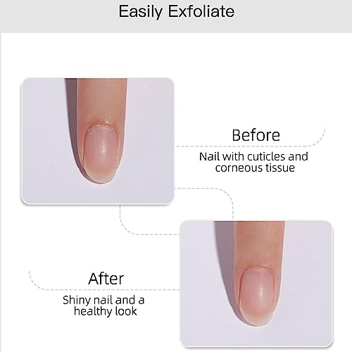 Cuticle Remover Gel - Cuticles Softener - Supremely Gentle Softens and Moisturizes - Dissolves Dry Cuticles in 1 minute