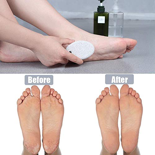 Pumice Stone 2Pcs, Natural Lava Pumice Stone for Feet/Hands/Body, White Calluse Remover/Foot Scrubber Stone for Dead/Hard Skin, Foot File for Men