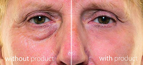 My Perfect Eyes - The Perfect Cosmetic Company Instant Anti-Aging Anti-wrinkles Eye Cream - Reduces Dark Circles Fine Lines and Puffiness Under E