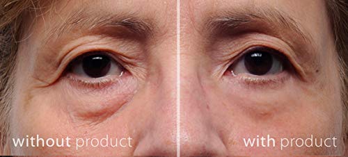 My Perfect Eyes - The Perfect Cosmetic Company Instant Anti-Aging Anti-wrinkles Eye Cream - Reduces Dark Circles Fine Lines and Puffiness Under E