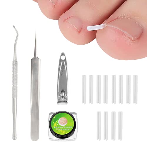 Ingrown Toenail Correction Treatment Kit with 12 Pcs Ingrown Toenail Correction Pad Recover Clips Ingrown Toenail Corrector Straightener Strips f