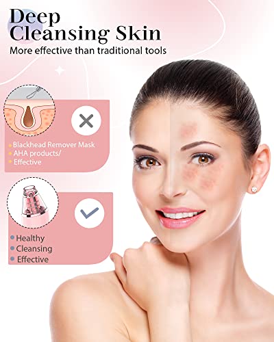 Pore Vacuum, Blackhead Remover Vacuum for Face Acne Comedone Whitehead Extractor Kit with 3 Suction Power & 4 Probes and LED Display Electric Bla