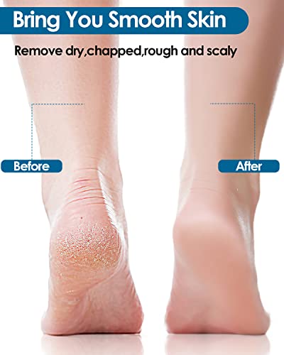 GJCrafts Paraffin Wax Bath for Hands And Feet, Removes Rough And Dry Skin, Promotes Blood Circulation, Parrafin Wax Heater for Skin Treatment, 3P