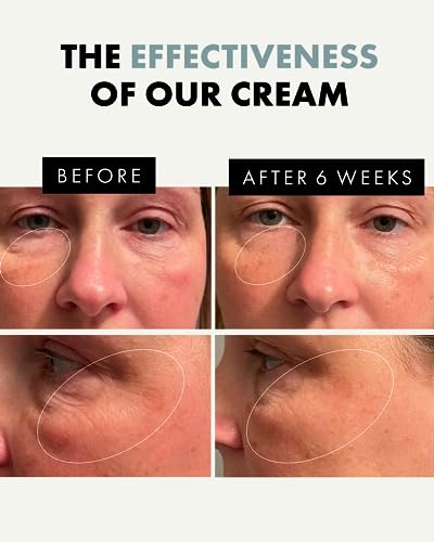 ORGANIC Eye Cream - 3X MORE POTENT ENCAPSULATED VITAMIN E Anti-Ageing with Soothing Oat Extract, HA and Antioxidants - GMP-Certified/DERMATOLOGIS