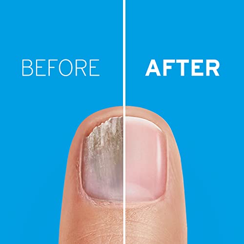 Excilor Nail Fungus Treatment ULTRA, Extra Strong Anti-Fungal Nail Treatment & Repair for Fingernails, Restores Beautiful & Healthy Nails