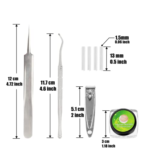 Ingrown Toenail Correction Treatment Kit with 12 Pcs Ingrown Toenail Correction Pad Recover Clips Ingrown Toenail Corrector Straightener Strips f