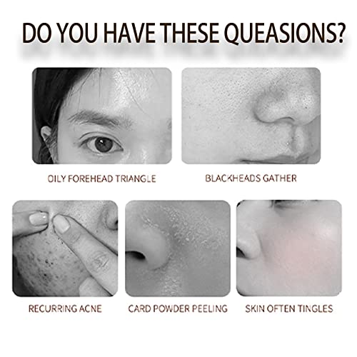 Hyaluronic Acid 2% + B5 30ML - Dark Spot Remover for Face -Hyaluronic Acid Serum for hydrated - Hyaluronic Acid Serum for Face - to Plump and Smo