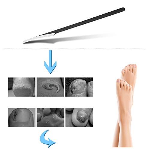 Dead Skin Removal, zukabmw Pedicure Hard Skin Remover Foot Care Callus Hard Tough Dead Skin Removal Scraper Pedicure Tool Callus Dead Dry Hard &