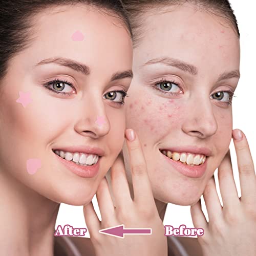 Pimple Patches, Pink Heart & Star Spot Patch Face, Nose, Forehead Fast Absorbing Acne Patch(72 Pcs)