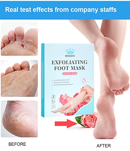 Foot Peel Mask WOOZHI, 2 Pack Foot Peeling Mask for Soft Baby Feet - Hard Skin Remover Foot Mask, Rose Foot Mask,Removes Calluses and Hard Skin,m