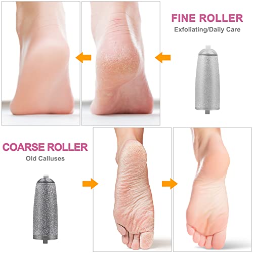 AirOpen Electric Foot File for Hard Skin, USB Rechargeable Pedicure Callus Remover with 2 Rollers and Storage Bag, Quick, Safe and Effective Foot