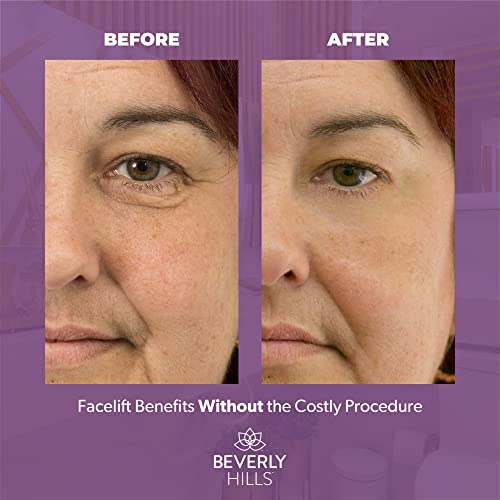 BEVERLY HILLS V-Lift Instant Eye Lift and Tuck Bee Venom Serum for Treating Puffy Eyes, Dark Circles, and Wrinkles