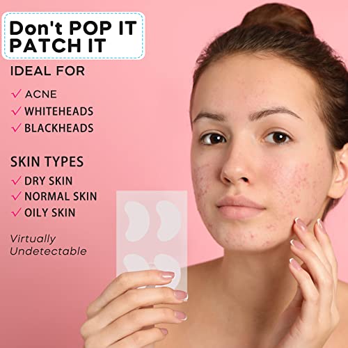 Spot Patches, Acne Patch 112 Pcs, Hydrocolloid Pimple Patches, Korintin Acne Patches for Large Zit Breakouts, 3 Sizes (8mm, 10mm, 38mm x 26mm)