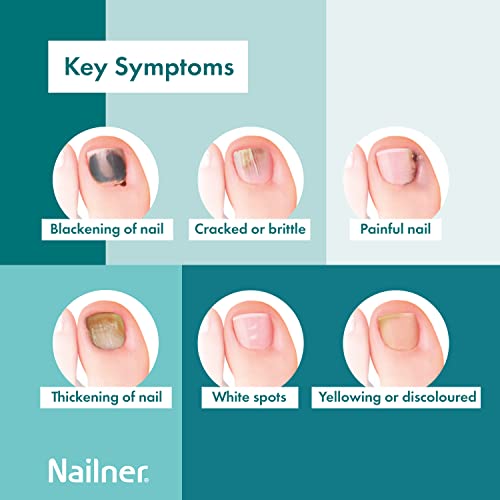 Nailner Treat & Colour Anti Fungal Nail Treatment Brush 2 x 5 ml Duo Pack for Toenails and Breathable Nail Varnish - Conceal, Treat & Prevent Fun