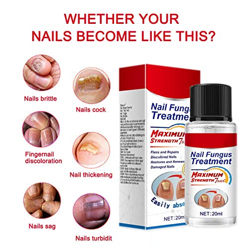 Fungal Nail Treatment 20ml, Extra Strong Nail Fungus Treatment for Toenail and Fingernail, Premium Fungal Nail Eliminator, Anti fungus Nail Repai