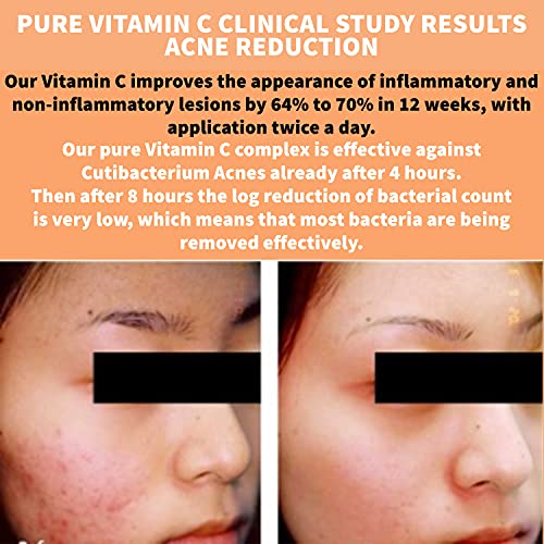 Nature Spell Pure Vitamin C Face Serum 30 ml - Brightens Skin - Minimise Enlarged Pores – Anti Aging Serum for Face - Suitable for All Skin Types