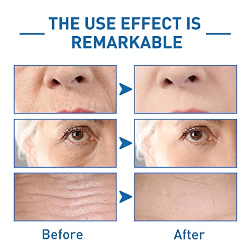 Botox Face Serum uk, Hyalu B5 Serum, Botox Stock Solution Facial Serum, Jennifer Aniston Anti Aging Serum, Botox in a Bottle Instant Face Tighten