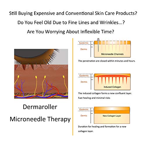 Derma Roller 9 Sizes Skiny Up® All in Titanium 540 Micro Needle Roller for Beard Hair Skin Face, Includes Instruction Storage Case (0.5mm)