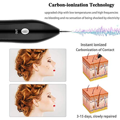 Skin Tags Remover Pen, VOONEEN Mole Remover with 9 Strength Levels &LED Spotlight, Portable Rechargeable Skin Tag Removal Pen for Wart, Freckle,