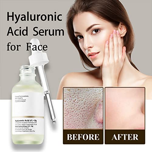 Hyaluronic Acid 2% + B5 30ML - Dark Spot Remover for Face -Hyaluronic Acid Serum for hydrated - Hyaluronic Acid Serum for Face - to Plump and Smo