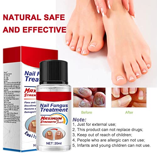 Fungal Nail Treatment 20ml, Extra Strong Nail Fungus Treatment for Toenail and Fingernail, Premium Fungal Nail Eliminator, Anti fungus Nail Repai