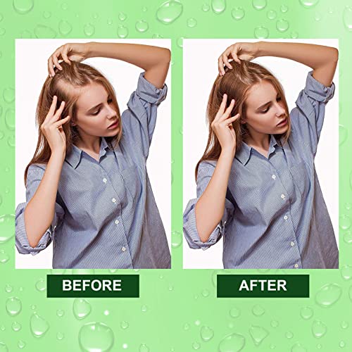 Rosemary Oil for Hair Growth, Rosemary Oil for Hair Loss Damaged Hair Stimulates Hair Growth, Nurshes Dry Scalp, 100% Pure Natural Rosemary Essen