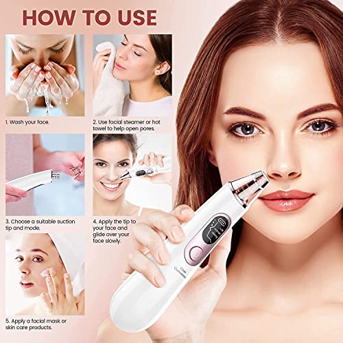 Blackhead Remover Vacuum, Electric Blackhead Remover Vacuum Pore Vacuum with 3 Levels and 4 Suction Heads - Blackhead Suction Remover Blackhead R