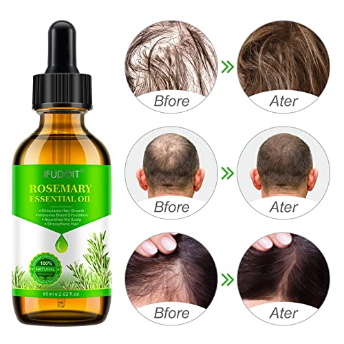 Rosemary Oil for Hair Growth, Skin Care, Eyebrow and Eyelash Growth - Hair Loss Treatment Oil for Women & Men, Improve Hair Loss and Nourishes Sc