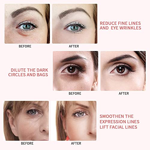 RETIMAX 1500 Vitamin A, Retinol, Protective Ointment, Anti-Ageing 30g