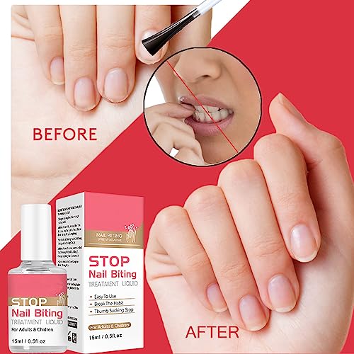 Anti Nail Biting Nail Polish, Stop Nail Repair Nail Varnish, Stop Biting Your Nails, Nail Biting Prevention, Clear Nail Varnish, Nail Biting Trea