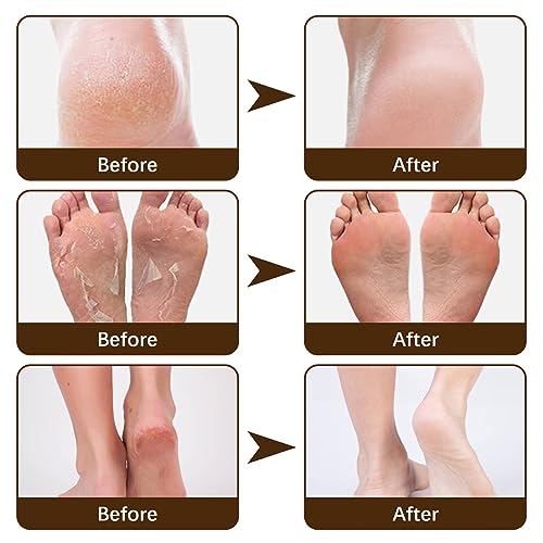 Cracked Skin Repair Cream,Foot Repair Cream,Anti Crack Heel Balm,Quickly Cracked Heel Repair Cream,Feet & Lip & Leg,Foot Cream For Cracked Heels