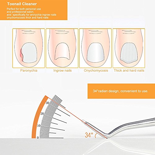 Anself Toenail Ingrowing Cleaner Double-ended Ingrown Toenails Lifter File Podiatry Stainless Steel Nail Care Chiropody Tool