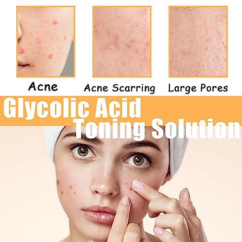 Glycolic Acid 7% Toning Solution,Hydrating Toner for Face,Toner for Acne Prone Skin,Glycolic Acid Skin Toner,Smoothing Face Toner for Dry Skin,Re