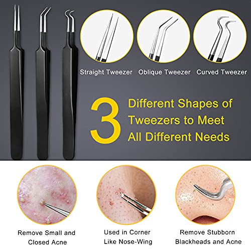 Boxoyx Pimple Popper Tool Kit - 10Pcs Blackhead Remover Comedone Extractor Tool Kit with Metal Case for Quick and Easy Removal of Pimples, Blackh