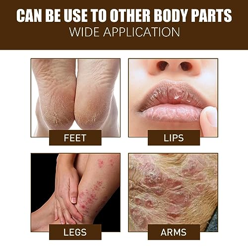Cracked Skin Repair Cream,Foot Repair Cream,Anti Crack Heel Balm,Quickly Cracked Heel Repair Cream,Feet & Lip & Leg,Foot Cream For Cracked Heels