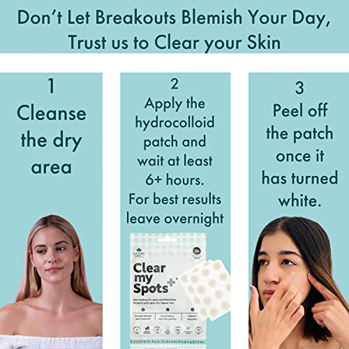 Clear My Spots Pimple Patches by Nature Spell - 36 Translucent Hydrocolloid Patches, Dots for Acne Spot Patches, Fast Healing Blemish Spot Treatm