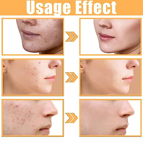 Glycolic Acid 7% Toning Solution,Hydrating Toner for Face,Toner for Acne Prone Skin,Glycolic Acid Skin Toner,Smoothing Face Toner for Dry Skin,Re