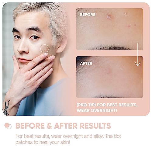 Breakoutaid Pimple patches infused with salicylic acid – Pack of 72 patches translucent Hydrocolloid pimple patch spot treatment stickers for fac