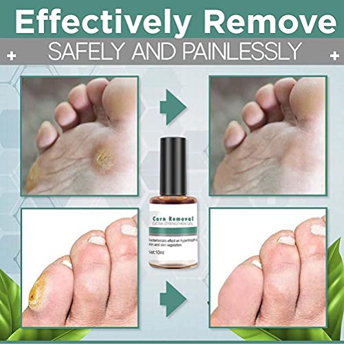 BTSEURY Wart Remover Extra Strengthen Gel, Corn Removal Extra Strengthen Gel, Quick Corn Remover Liquid, Mild Corn Callus Remover for Feet