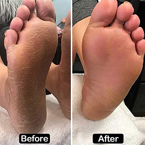 Electric Foot File Hard Skin Remover (Speed Adjustable) with 60pcs Replacement Sandpaper Disks, Professional Electric Callus Remover Pedicure Foo