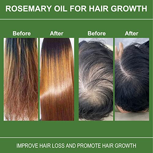 Rosemary Oil for Hair Growth, Rosemary Oil for Hair Loss Damaged Hair Stimulates Hair Growth, Nurshes Dry Scalp, 100% Pure Natural Rosemary Essen