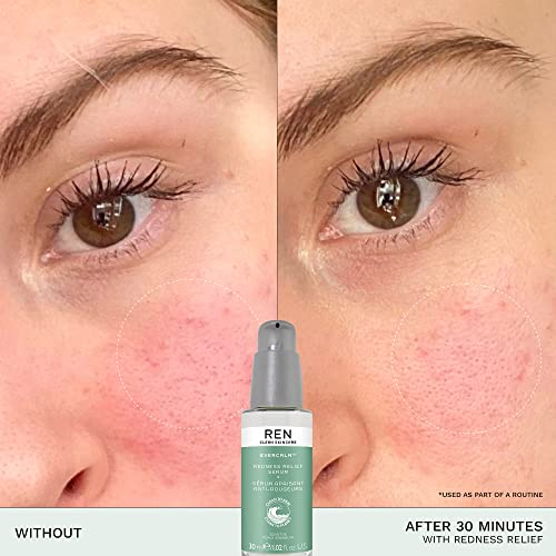 REN Clean Skincare Evercalm™ Redness Relief Serum | Fast -Acting to Reduce & Relieve Redness | Calm Sensitive Skin | Step 2: Treat